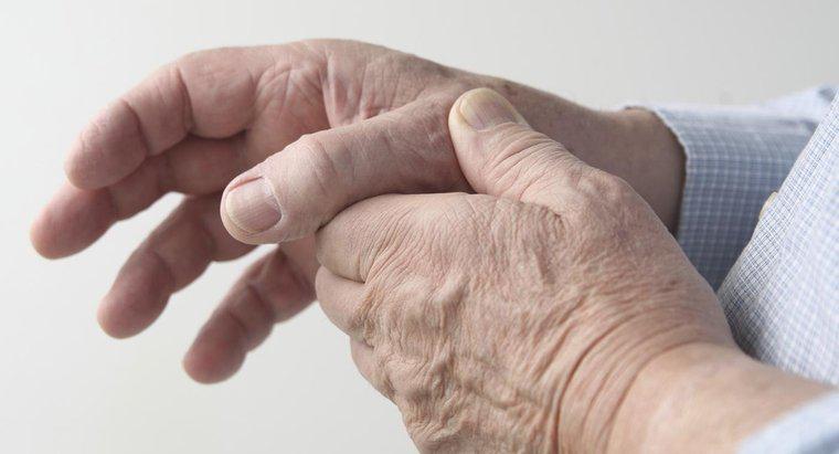 Artrit Ellerine Yardımcı Olmak İçin En İyi Tedavi Nedir?