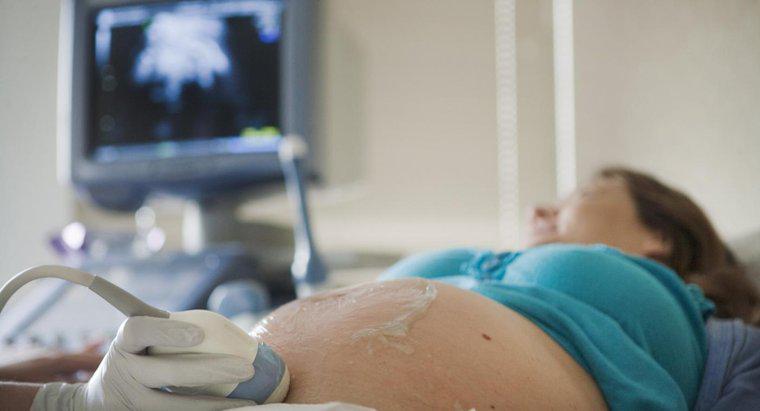 Bir Ultrason Bebeğin Cinsiyetini Ne Zaman Gösterecek?