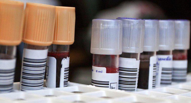 Nötrofillerin Kan Testi Nedir?