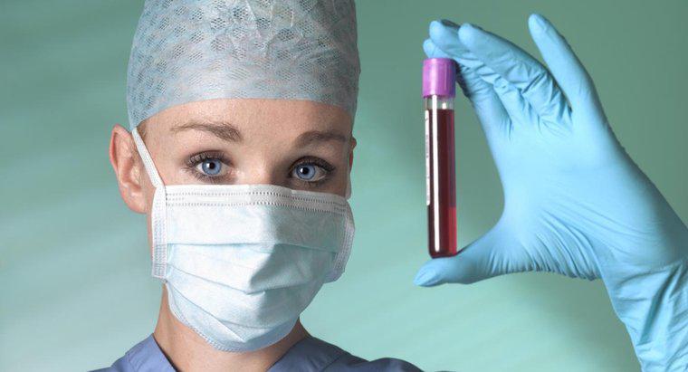 Bir Anyon Açığı Kan Testinden Hangi Koşullar Belirlenebilir?