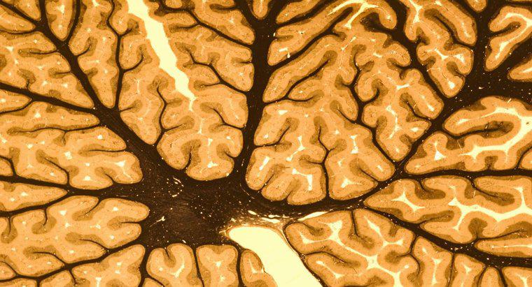 Sinir Sisteminin İki Ana Parçası Nelerdir?