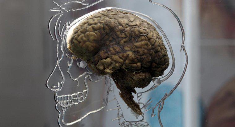 Beyin Lezyonunun Belirtileri Nelerdir?