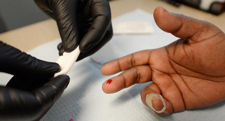 HIV'in Testlere Çıkması Ne Kadar Sürer?