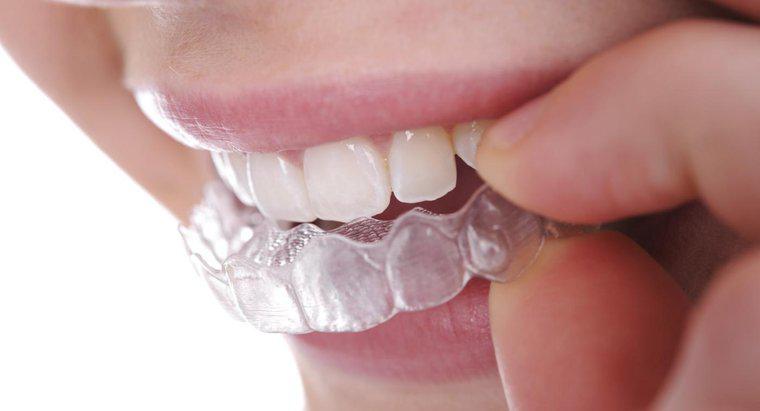 Parantezsiz Dişleri Nasıl Düzeltirsiniz?