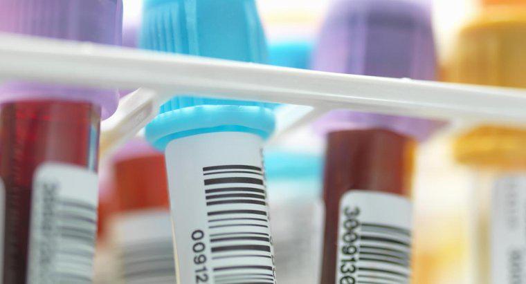BMP Laboratuvarı Testi için Hangi Renk Tüpü Kullanılır ve Ne Kadar Kan Kullanılır?