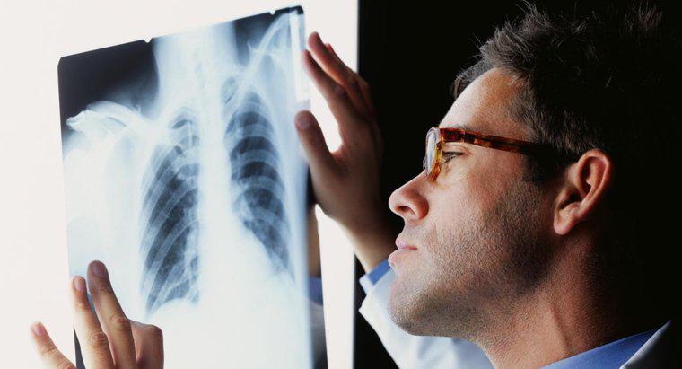 Bir Akciğer Enfeksiyonu Nasıl Tedavi Edilir?