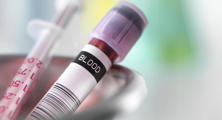 Doktorlar Düşük Hemoglobin Sayımının Sebebini Nasıl Teşhis Ederler?
