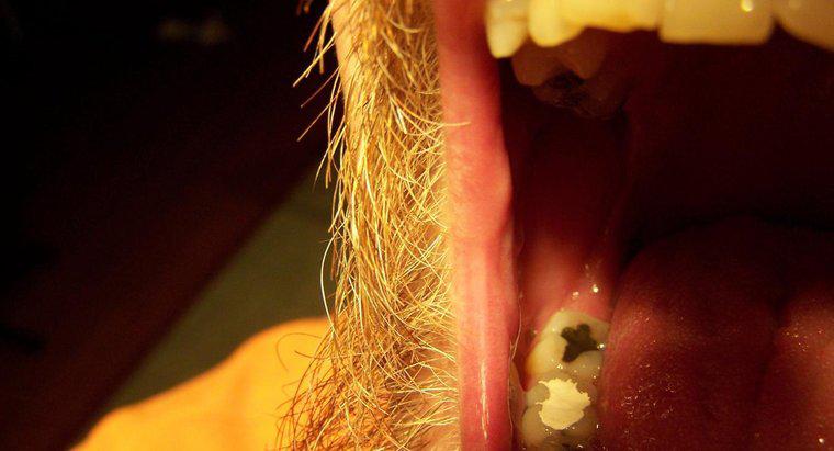 Ev yapımı bir diş dolgusu nasıl yapılır?