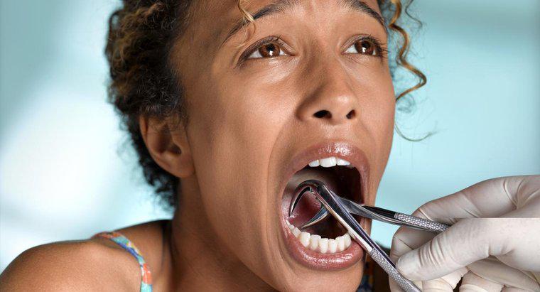 Diş Çekimi Sonrası Enfeksiyonları Nasıl Tedavi Ediyorsunuz?