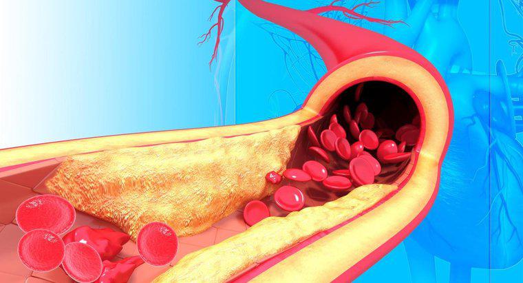 Arterlerin Yapısı Nedir?