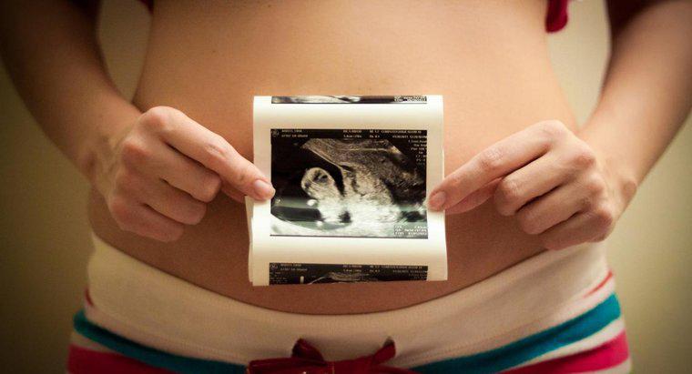 Prenatal Gelişimin Doğru Aşama Düzeni Nedir?