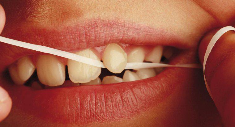 Diş ipi ne yapılır?
