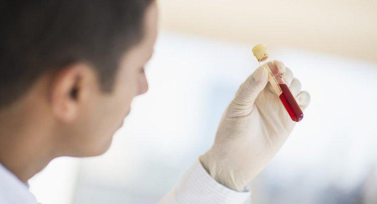 Kemik Profili Kan Testi Nedir?