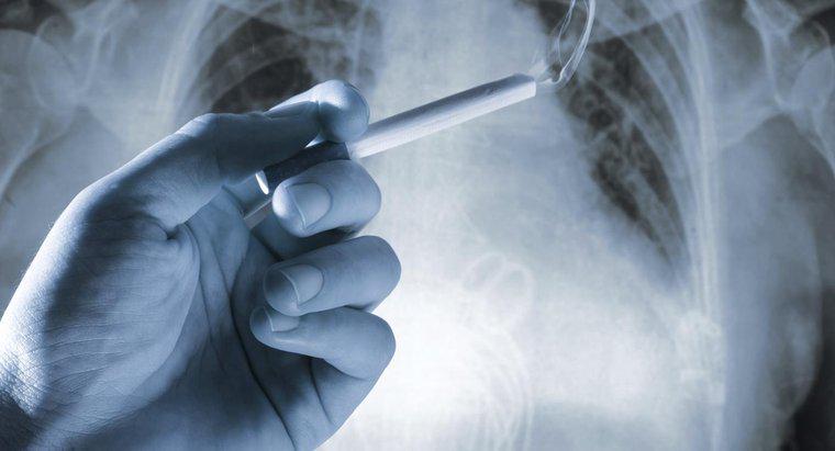 Akciğer Kanserinin Bazı Belirtileri Nelerdir?