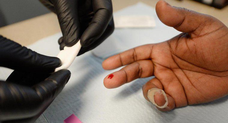HIV'in Erken Belirtileri Nelerdir?