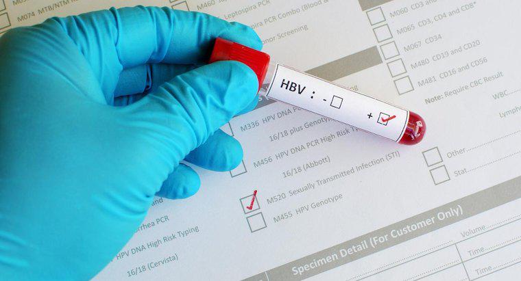 Hepatit B Çekirdek Testinde Pozitif Sonuç Ne Gösterir?