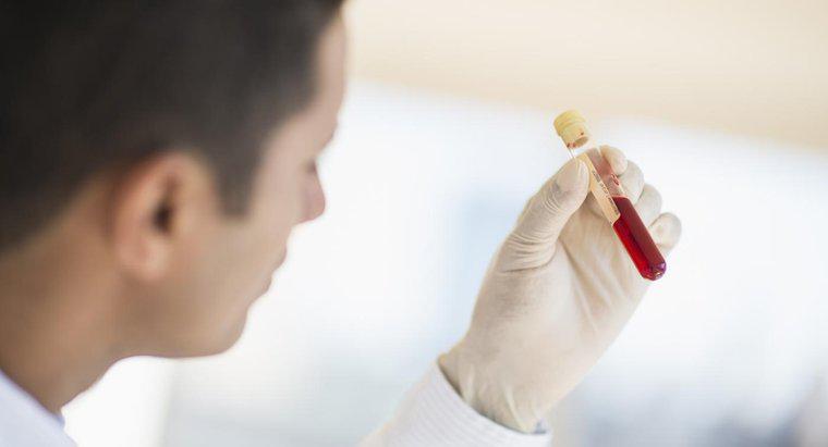 Kan Testi İçin Ne Kadar Hızlı İhtiyacınız Var?