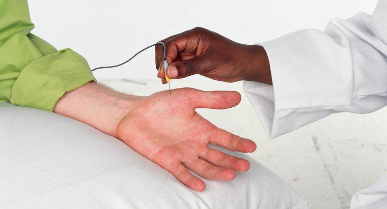 EMG Testi Sinir Hasarını Nasıl Değerlendirir?