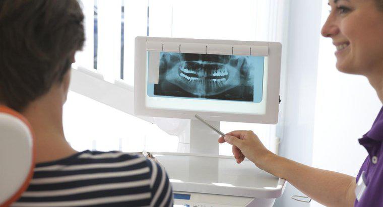 Mini Dental İmplantların Artıları ve Eksileri Nedir?