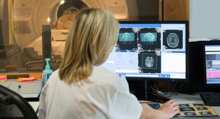 Beyin MRI'sındaki Beyaz Nokta Ne Demektir?