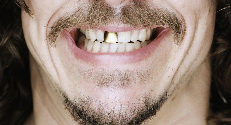 Altın Dişleri Nasıl Temizlersiniz?