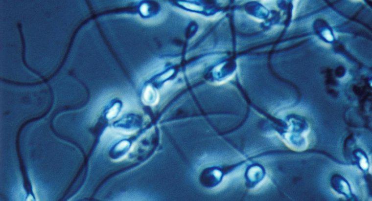 Anormal Sperm Morfolojisi için Tedaviler Nelerdir?