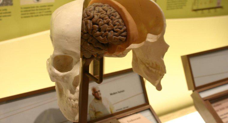 Büyümüş Beyin Ventriküllerinin Neleri Gösterir?
