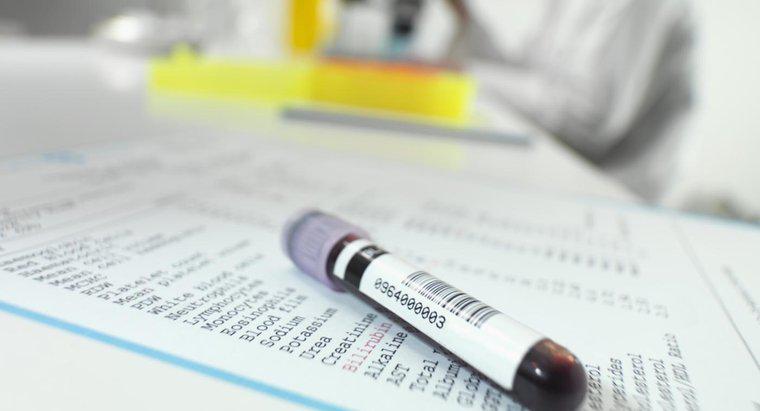 Kan Testi Laboratuarında "LY" Neyi Gösterir?