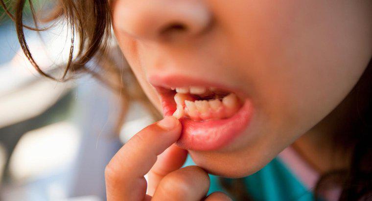 Yetişkinlerde Gevşek Dişlerin Nedenleri Nedir?