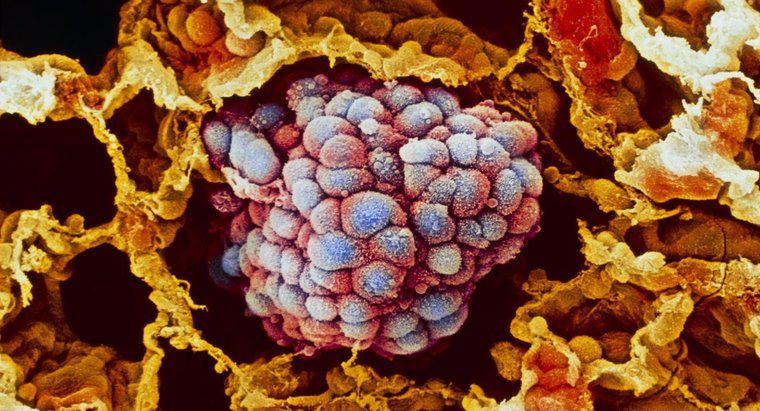 Kanser Öncesi Hücreler Nedir?