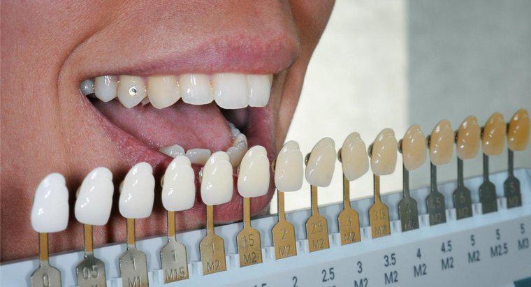 Sahte Dişler Beyazlatılabilir mi?