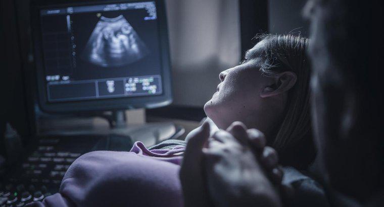 Ultrason sırasında bebeğin kalp atışını duymak için ne kadar zamana ihtiyacınız var?