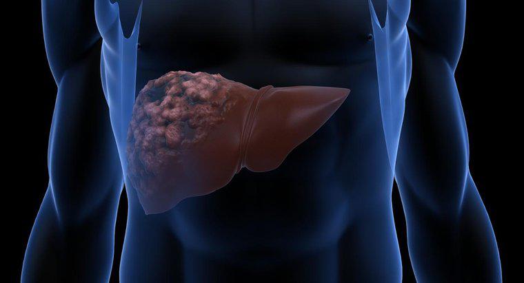Karaciğer Hastalığının Sebepleri Nelerdir?