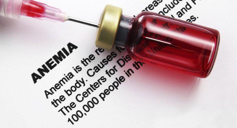 Anemi için Kan Sayımı Seviyelerini Nasıl Test Edebilirsiniz?