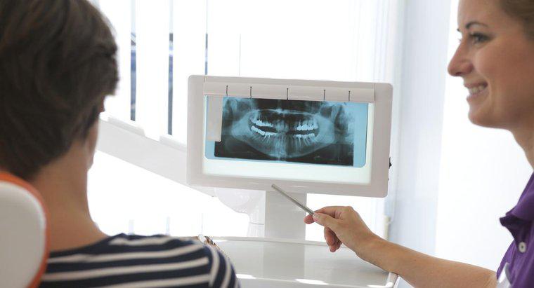 Dental İmplantlar İçin Ne Kadar Ödedi?